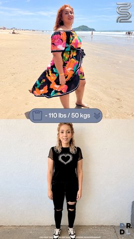 Paciente antes y después, bajó 50 kg